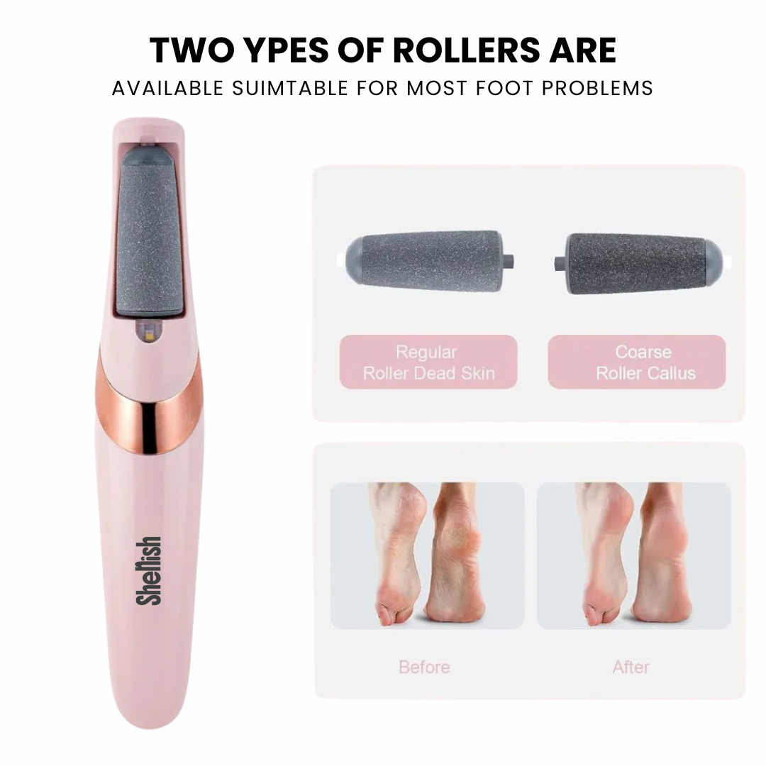 ™ Callus Remover