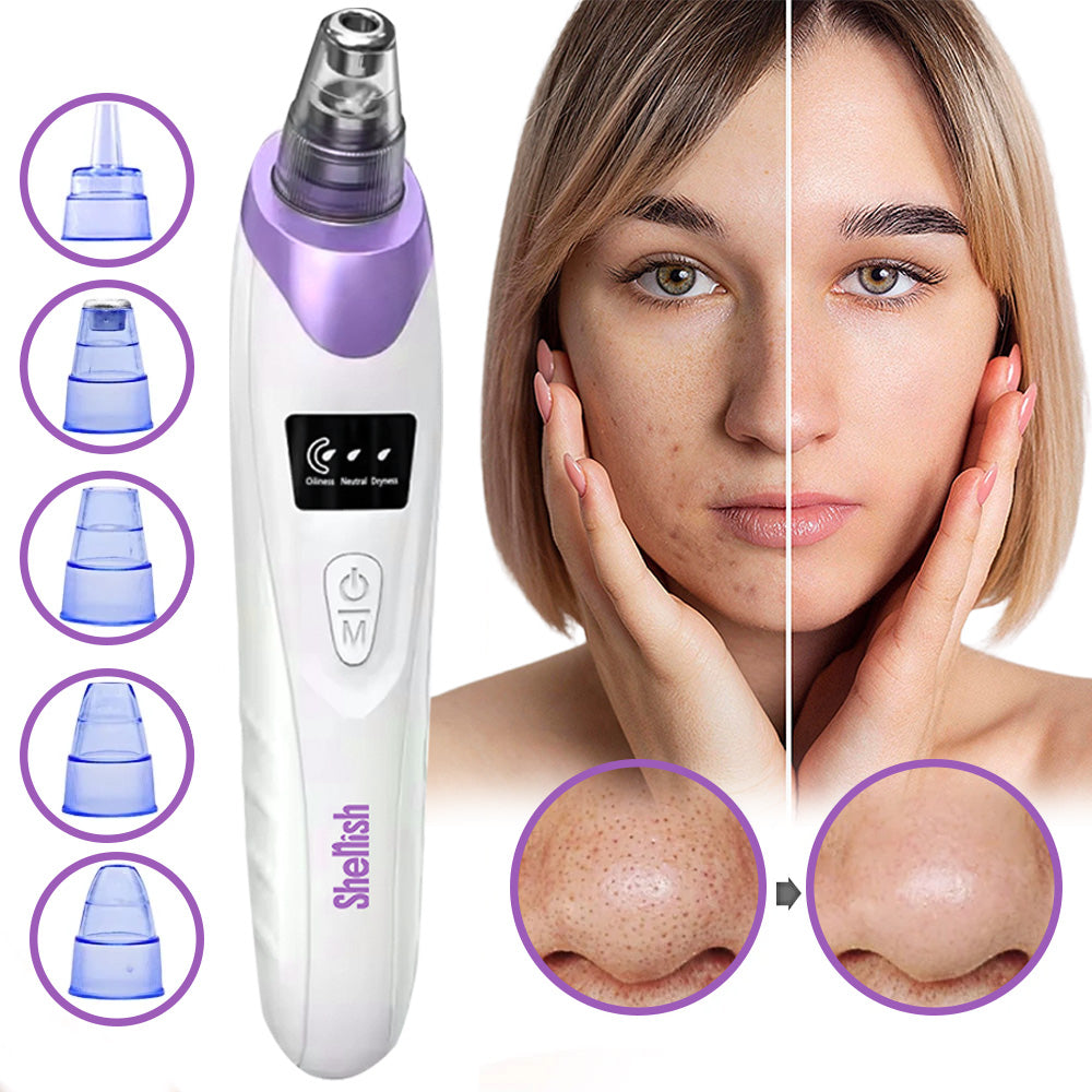 Imported™ Vacuum Pore Cleaner - Remove Blackheads Without Irritation or Redness