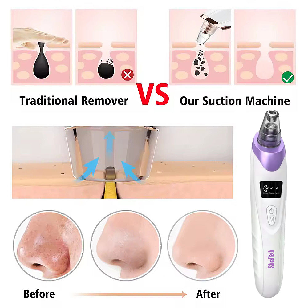 Imported™ Vacuum Pore Cleaner - Remove Blackheads Without Irritation or Redness