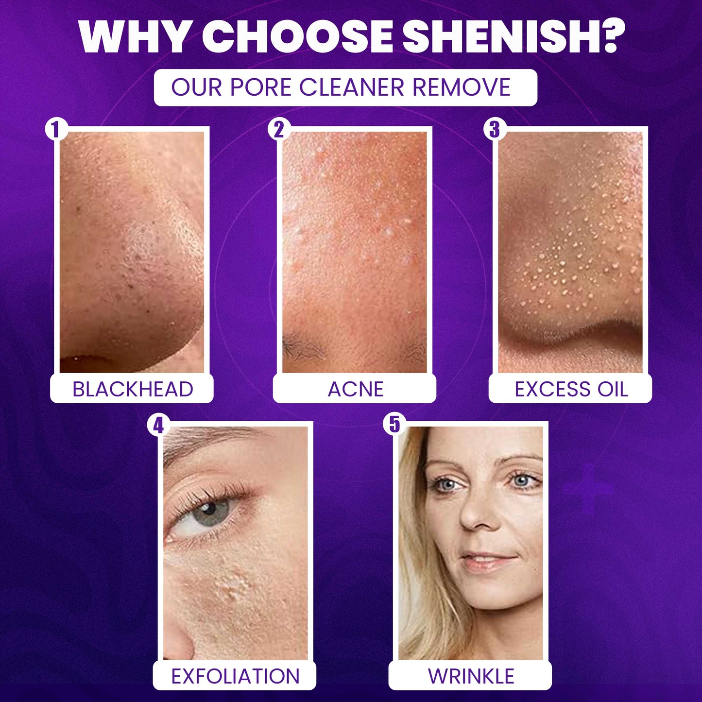 Imported™ Vacuum Pore Cleaner - Remove Blackheads Without Irritation or Redness